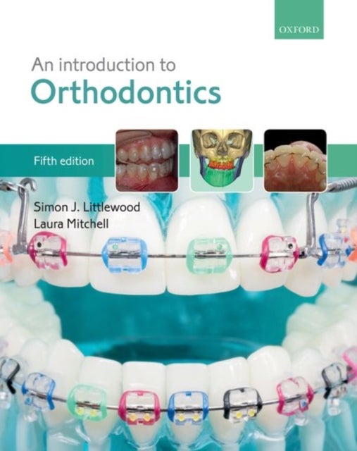 Bilde av An Introduction To Orthodontics Av Simon J. (consultant Orthodontist And Specialty Lead Consultant Orthodontist And Specialty Lead St. Luke&#039;s Hos