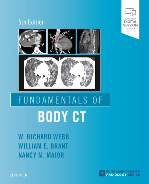 Bilde av Fundamentals Of Body Ct Av W Richard Md (professor Emeritus Of Radiology And Biomedical Imaging Emeritus Member Haile Debas Academy Of Medical Educato