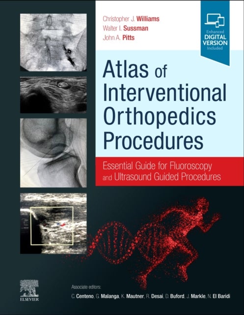 Bilde av Atlas Of Interventional Orthopedics Procedures