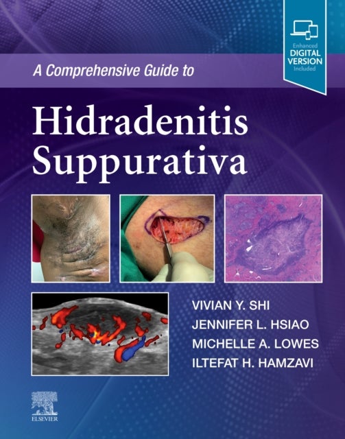 Bilde av A Comprehensive Guide To Hidradenitis Suppurativa Av Vivian Y. Md (associate Professor Department Of Dermatology University Of Arkansas For Medical Sc