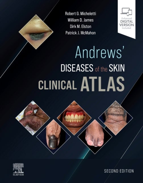 Bilde av Andrews&#039; Diseases Of The Skin Clinical Atlas Av Robert G. Md (assistant Professor Of Dermatology Department Of Dermatology Hospital Of The Univer