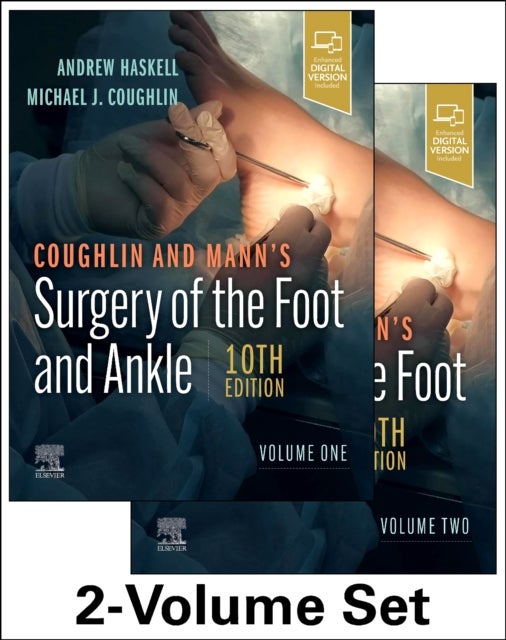 Bilde av Coughlin And Mann&#039;s Surgery Of The Foot And Ankle, 2-volume Set