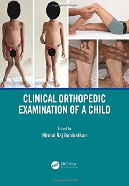 Bilde av Clinical Orthopedic Examination Of A Child