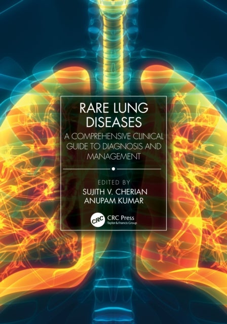 Bilde av Rare Lung Diseases