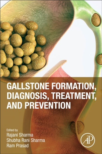 Bilde av Gallstone Formation, Diagnosis, Treatment And Prevention
