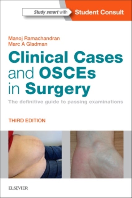 Bilde av Clinical Cases And Osces In Surgery Av Manoj (consultant Paediatric And Young Adult Orthopaedic Surgeon Barts And The London Nhs Trust London Ramachan