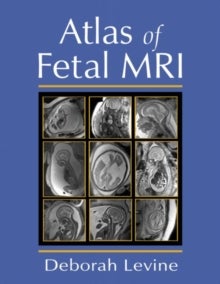 Bilde av Atlas Of Fetal Mri Av Deborah (beth Israel Deaconess Medical Center Boston Ma Usa) Levine