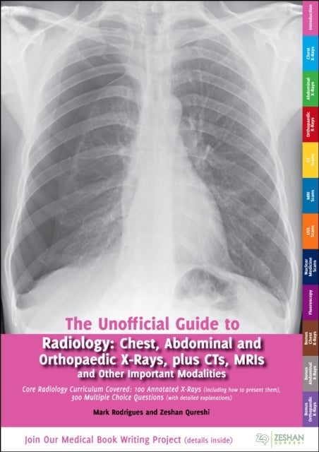 Bilde av Unofficial Guide To Radiology Av Mark A Rodrigues, Zeshan Bm Bsc(hons) Msc Bm Mrcpch Facadmed Mrcps(glasg) (paediatric Registrar London Deanery United