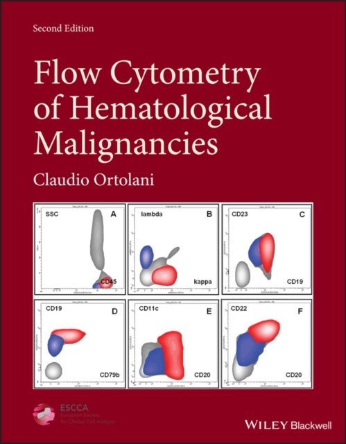 Bilde av Flow Cytometry Of Hematological Malignancies Av Claudio (consultant Clinical Pathologist (retired) Ospedale Dell&#039;angelo Venice Italy) Ortolani