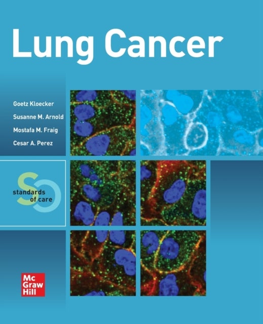 Bilde av Lung Cancer: Standards Of Care Av Goetz Kloecker, Mostafa Fraig, Susanne M. Arnold, Cesar A. Perez