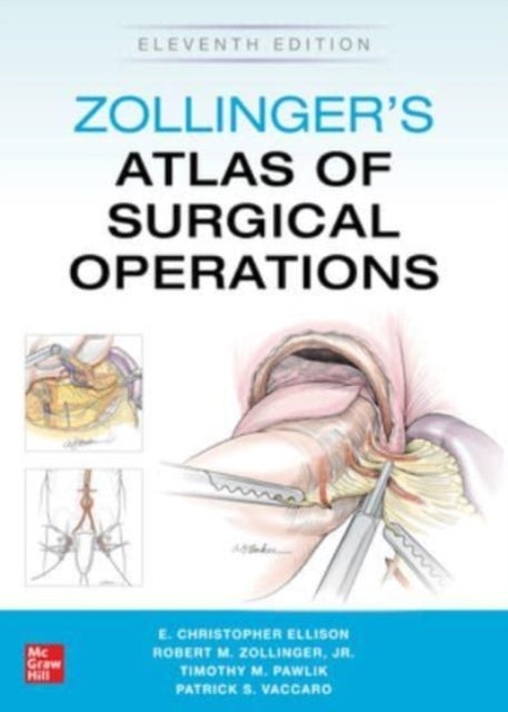 Bilde av Zollinger&#039;s Atlas Of Surgical Operations, Eleventh Edition Av Robert Zollinger, E. Ellison, Timothy Pawlik, Patrick Vaccaro