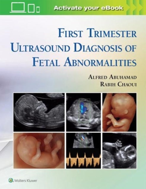 Bilde av First Trimester Ultrasound Diagnosis Of Fetal Abnormalities Av Alfred Z. Abuhamad, Rabih Chaoui