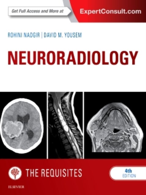 Bilde av Neuroradiology: The Requisites Av Rohini (assistant Professor Radiology And Radiological Science&lt;br&gt;johns Hopkins School Of Medicine&lt;br&gt;fa