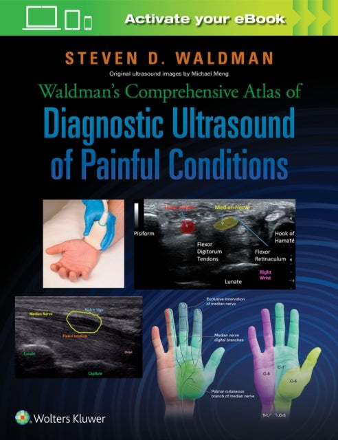 Bilde av Waldman&#039;s Comprehensive Atlas Of Diagnostic Ultrasound Of Painful Conditions Av Steven Waldman