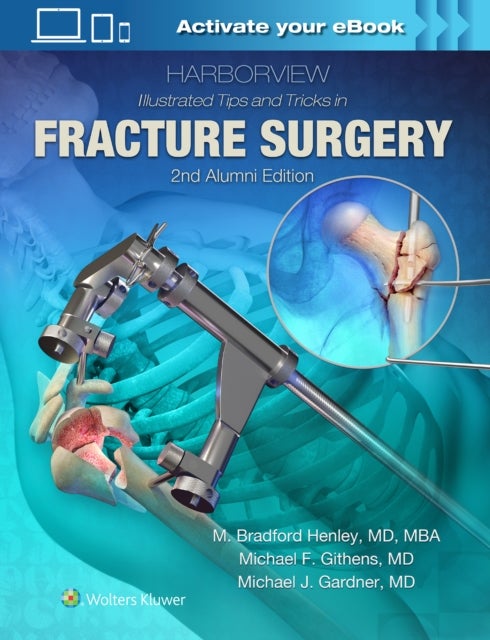 Bilde av Harborview Illustrated Tips And Tricks In Fracture Surgery Av M. Henley