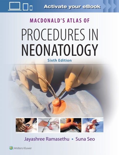 Bilde av Macdonald&#039;s Atlas Of Procedures In Neonatology
