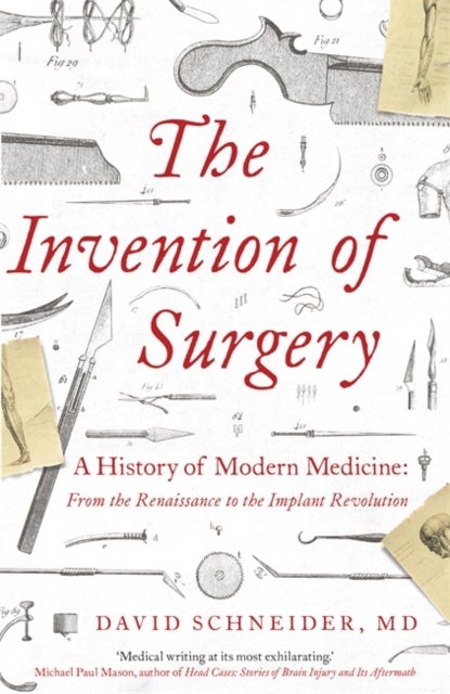 Bilde av The Invention Of Surgery Av David Schneider