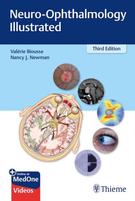 Bilde av Neuro-ophthalmology Illustrated Av Valerie Biousse, Nancy Newman