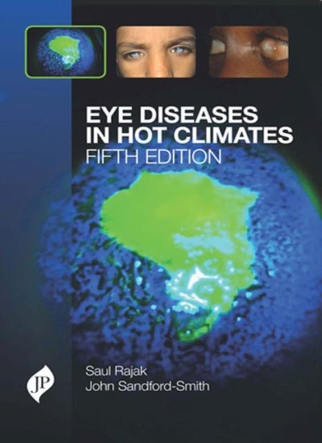 Bilde av Eye Diseases In Hot Climates Av Saul N Rajak, John Sandford-smith