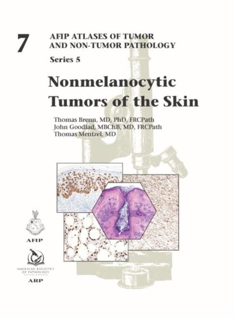 Bilde av Nonmelanocytic Tumors Of The Skin Av Thomas Brenn, John Goodlad, Thomas Mentzel