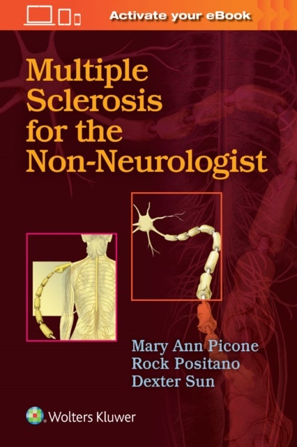 Bilde av Multiple Sclerosis For The Non-neurologist Av Mary Ann Picone