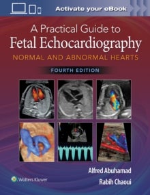 Bilde av A Practical Guide To Fetal Echocardiography Av Alfred Z. Abuhamad, Rabih Chaoui