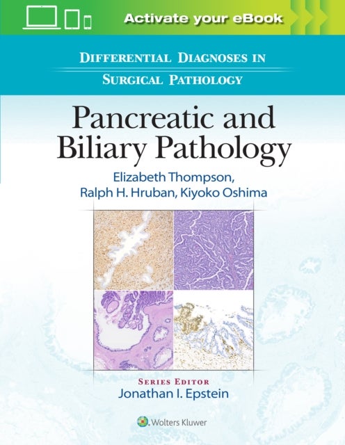 Bilde av Differential Diagnoses In Surgical Pathology: Pancreatic And Biliary Pathology Av Elizabeth Dell Md Phd Thompson, Ralph H. Hruban, Kiyoko Oshima