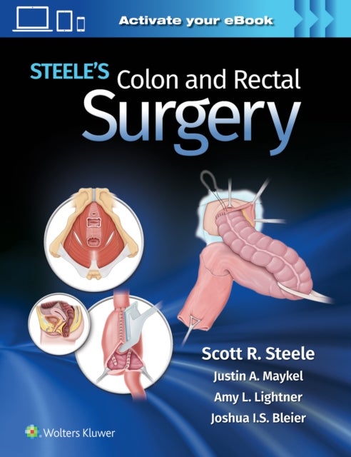 Bilde av Steele&#039;s Colon And Rectal Surgery