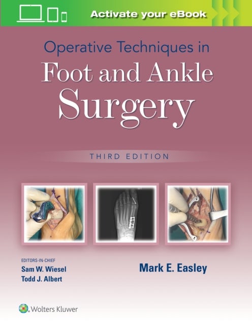 Bilde av Operative Techniques In Foot And Ankle Surgery Av Mark E. Easley