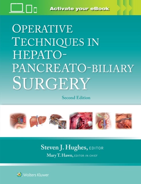 Bilde av Operative Techniques In Hepato-pancreato-biliary Surgery