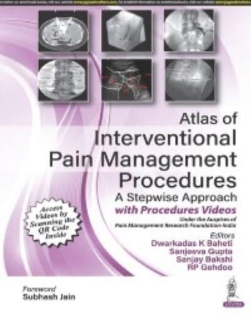 Bilde av Atlas Of Interventional Pain Management Procedures Av Dwarkadas K Baheti, Sanjeeva Gupta, Sanjay Bakshi, Rp Gehdoo